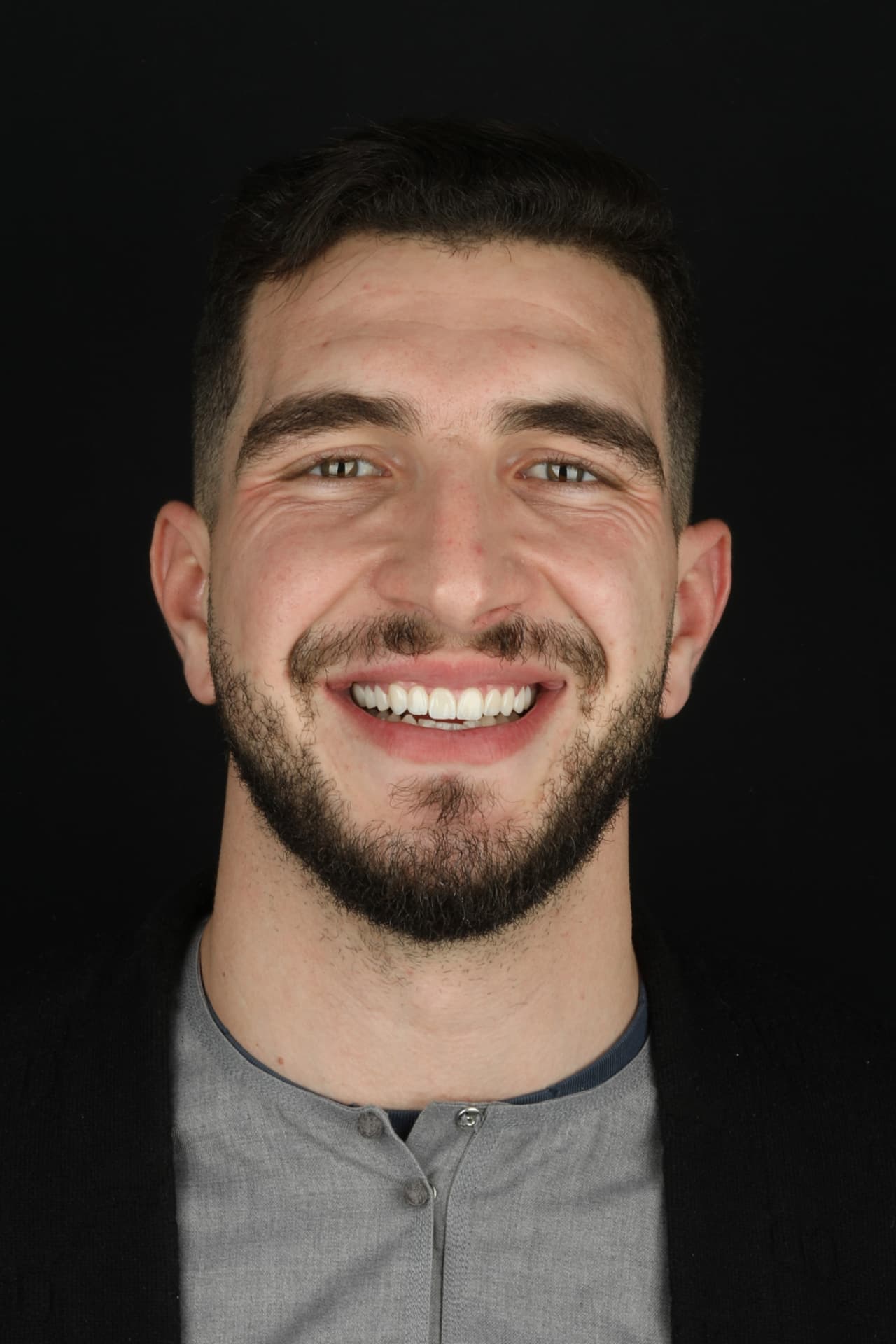 Portrait du même patient après réhabilitation du sourire